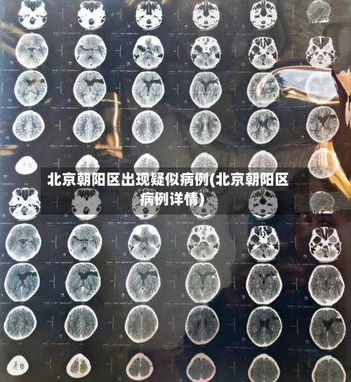 北京朝阳区出现疑似病例(北京朝阳区病例详情)-第2张图片