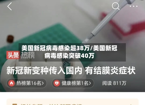 美国新冠病毒感染超38万/美国新冠病毒感染突破40万